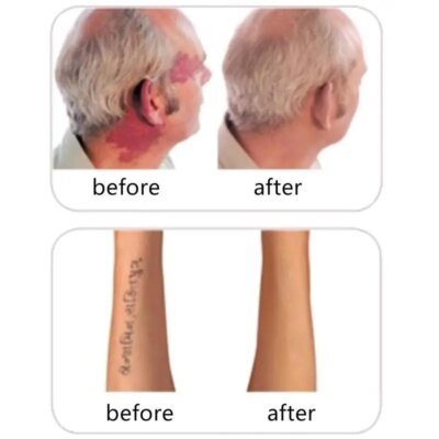 25094-725d12.jpg CamSolomon-Bâton correcteur pour la peau, 2 pièces/ensemble, crème de maquillage pour tatouage, cicatrice et marque de naissance